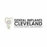 dentalimplants_