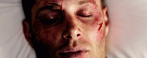Open your eyes Dean! 
Season 10 Episode 23

SUPERNATURAL