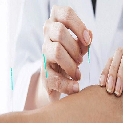 banner-dry-needling-1.jpg