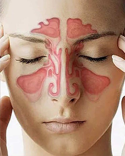 img-sinus-headache.jpg