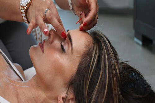 img-dry-needling.jpg