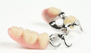 Partial-Dentures-300x175.jpg