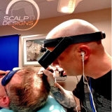 Scalp-Micropigmentation-Near-Me.png