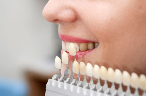 Mittal Dental Clinic is one of the best dental clinics in Jaipur, specializing in Cosmetic Dentistry, Root Canal Treatment, Dental Implants, and Dental Fillings

Read More: https://mittaldentalclinic.com