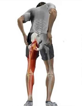 img-sciatica02.jpg