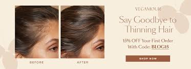 Hair-Loss-Clinic-in-Boston.jpg
