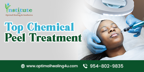 Top-Chemical-Peel-Treatment.png