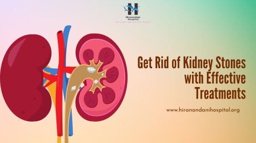 Get-Rid-of-Kidney-Stones-with-Effective-Treatments.jpg