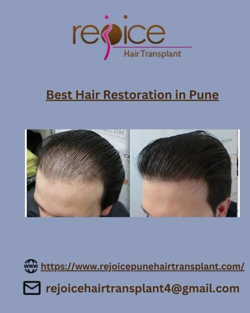 Dr. Shankar Sawant, when he founded Rejoice™ had only one thing in mind.He wanted to provide world-class services of hair transplant in India. And since 2002, we’ve been helping people fight hair loss and baldness.Team Rejoice™ is one of the best hair transplant teams in India.Our experienced doctors led by Dr. Shankar Sawant are experts in their respective domains. They are humble and passionate about serving people. Rejoice gives Best Hair Restoration in Pune
View More at: https://www.rejoicepunehairtransplant.com/