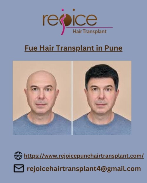 Dr. Shankar Sawant, when he founded Rejoice™ had only one thing in mind.He wanted to provide world-class services of hair transplant in India. And since 2002, we’ve been helping people fight hair loss and baldness.Team Rejoice™ is one of the best hair transplant teams in India.Our experienced doctors led by Dr. Shankar Sawant are experts in their respective domains. They are humble and passionate about serving people. Rejoice gives Best Fue Hair Transplant in Pune
View More at: https://www.rejoicepunehairtransplant.com/