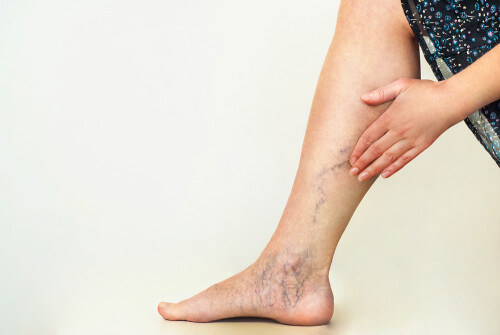 Suffering from leg pain? Vascsa.com is here to help! Our compassionate team of experts provides personalized treatment plans to help you find relief and get back to living your life.

https://vascsa.com/services/peripheral-artery-disease/