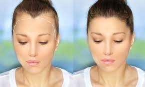 Hairline-Shapes-For-Women-Scalps.jpg