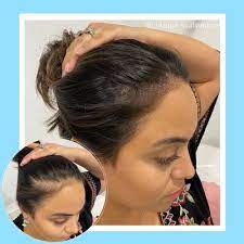 Scalp-Micropigmentation-For-Women.jpg