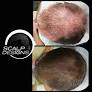 Best-Scalp-Micropigmentation-For-Long-Hair.jpg