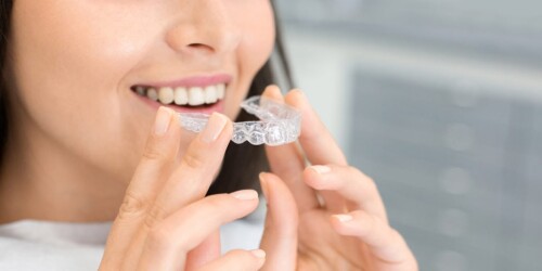 At Wortleyroaddental.com, you can find out the cost of Invisalign aligners with ease. With our friendly and caring team, we'll help you find the perfect solution for your smile. Get your confidence back today!



https://wortleyroaddental.com/special-treatments/invisalign
