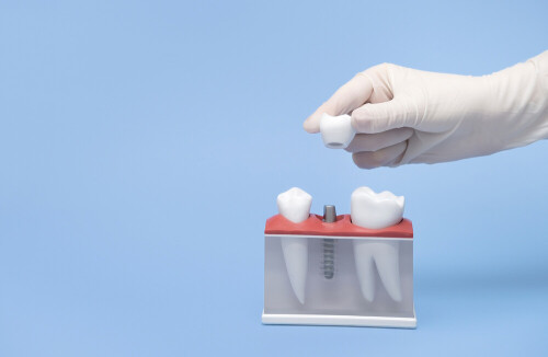 Looking for dental implants? Ziondentals.com offers the best prices and the highest quality of care for your dental implant needs. Get the answers to "How much" today!



https://ziondentals.com/implant/