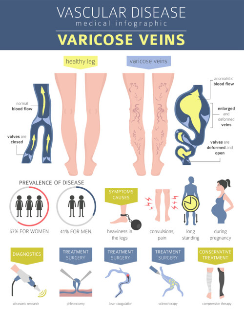 You should feel comfortable in your skin regardless of spider veins. For therapies that will help you feel your best, Vascsa.com offers safe and efficient options.https://vascsa.com/services/spider-veins/