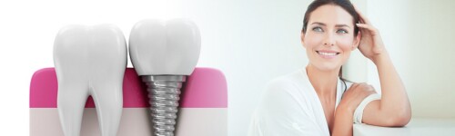 With Norwooddentistry.ca multiple dental implants, you can regain your smile. We offer specialist services to help you regain your confidence and oral health. Make your reservation today!

https://www.norwooddentistry.ca/services/dental-implants.html