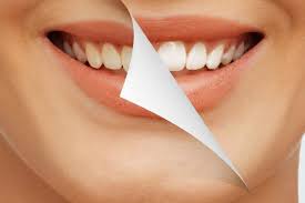 Teeth-Whitening-Republic-MO.jpg
