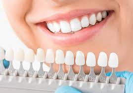 The-Top-Teeth-Whitening-Solutions-in-Republic-MO.jpg