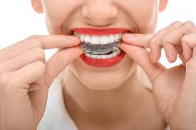 Top-Dental-Mouthguards-in-Yakima-WA---Yakima-Valley-Dentistry.jpg