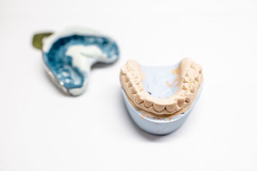 Top-Dental-Mouthguards-in-Yakima-WA---Yakima-Valley-Dentistry.jpg