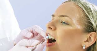 The-Premier-Family-Dentist-in-Buffalo-MO.jpg