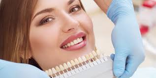 Discover-the-Best-Veneers-in-Turlock-CA.jpg