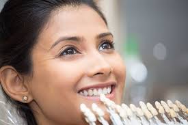 Discover-the-Best-Veneers-in-Turlock-CA.jpg