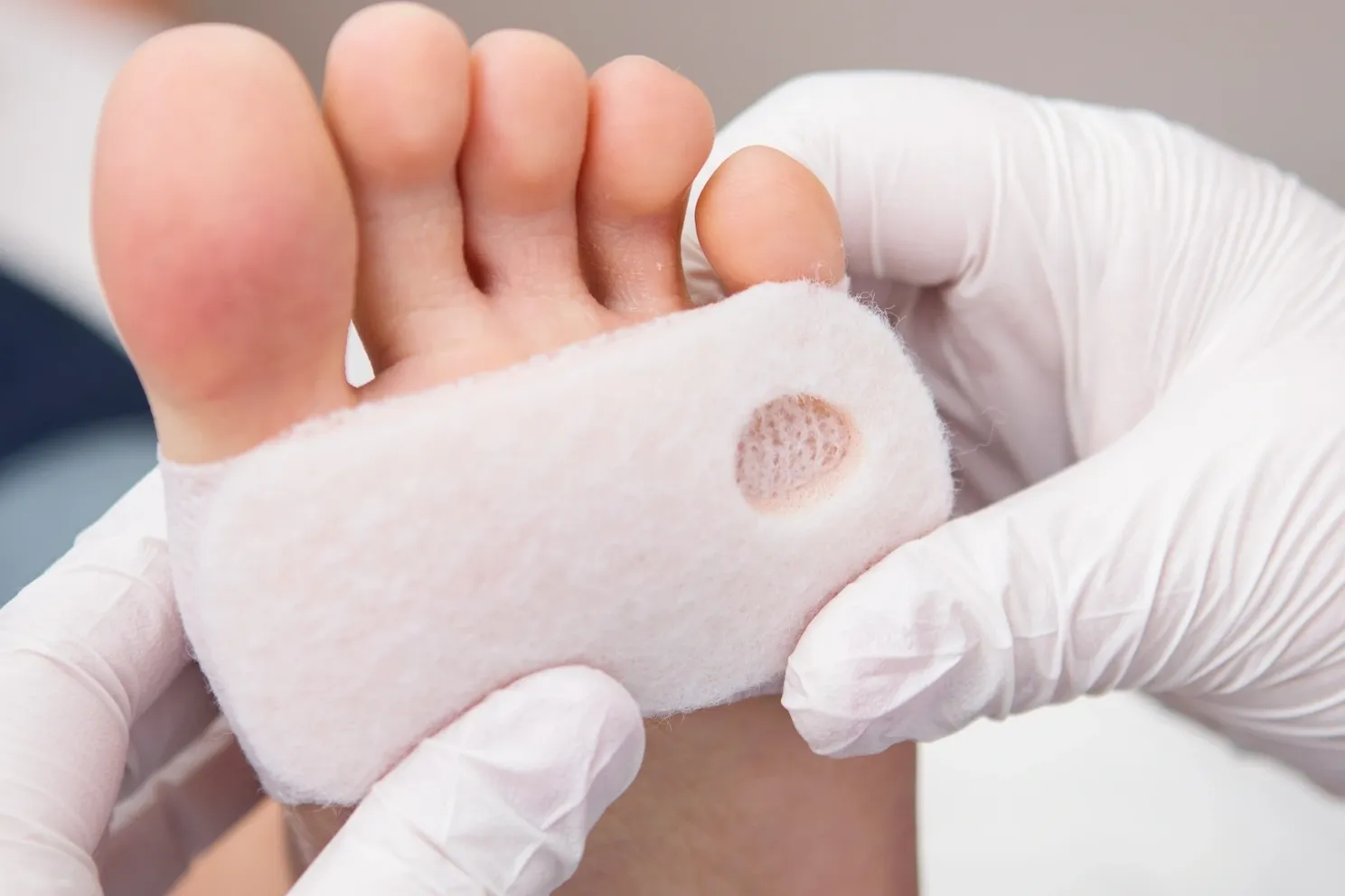 Optimizing Foot Health: How Vaporox Treatment is Transforming Wound Care Optimizing Foot Health: How Vaporox Treatment is Transforming Wound Care