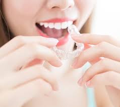 The-Best-Way-to-Achieve-a-Stunning-Smile-Invisalign-in-Naperville.jpg