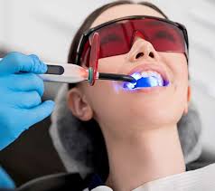 Teeth-Whitening-Services-in-Greenbrier-TN.jpg