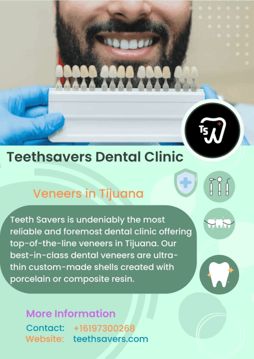 Veneers-in-Tijuana.gif