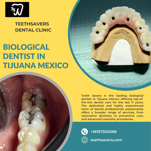 Biological-dentist-in-tijuana-Mexico.gif