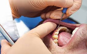 The-Best-Gum-Disease-Treatment-in-Republic-MO.jpg