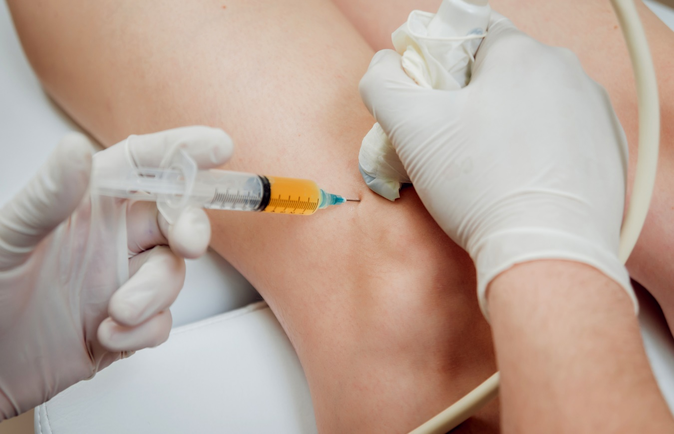 A Guide to PRP Injections for Knee Pain Relief: Benefits and Costs in Malaysia